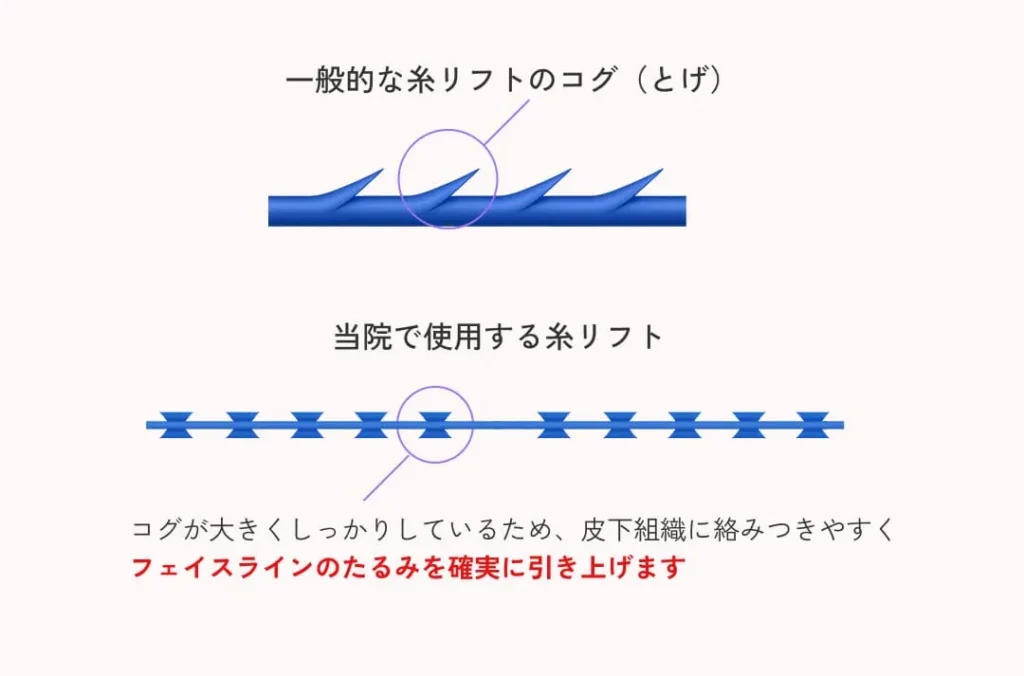 当院で使用する糸のこだわり