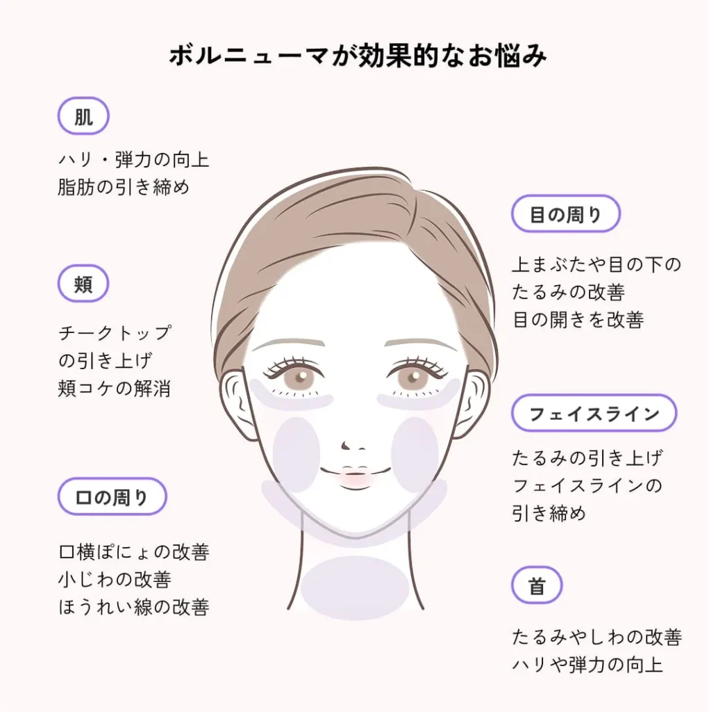 効果的なお悩みや適応部位