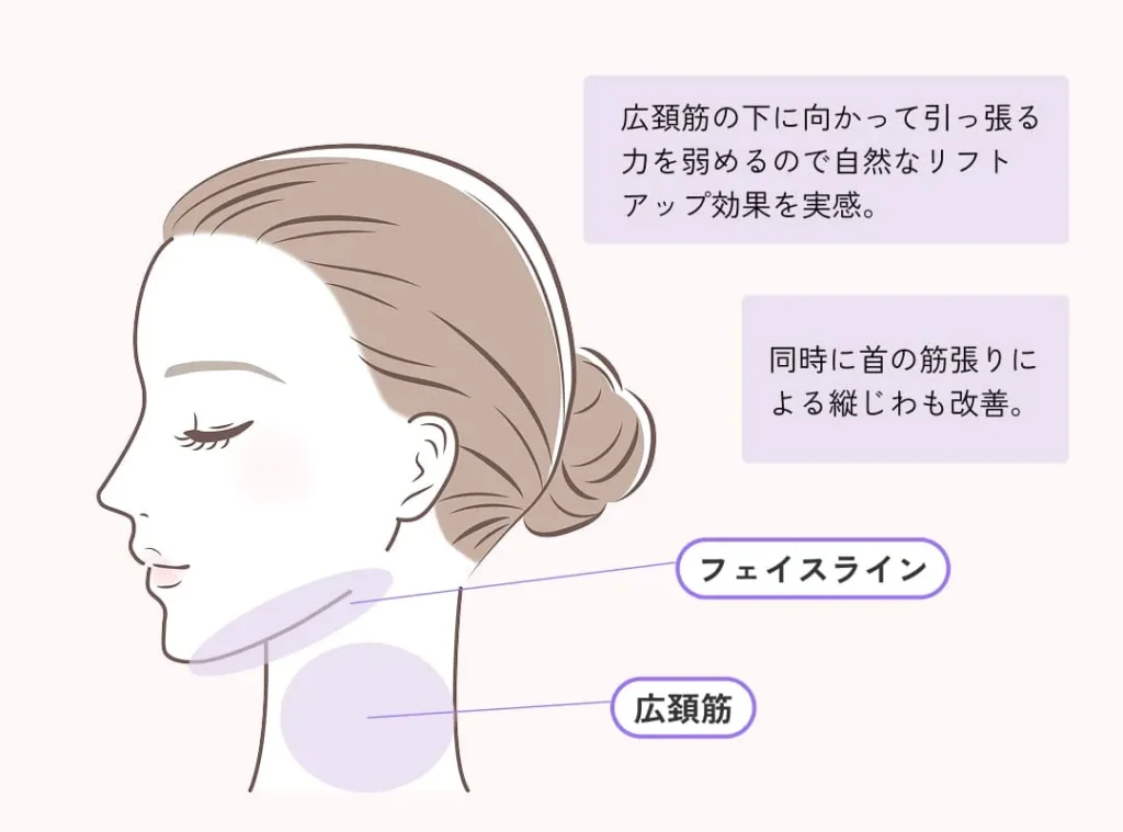 ボトックスリフト(顔のリフトアップ•首のしわやたるみ)