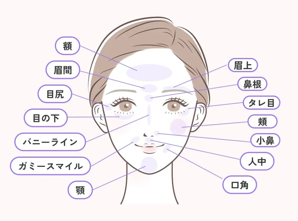 顔の表情じわボトックス