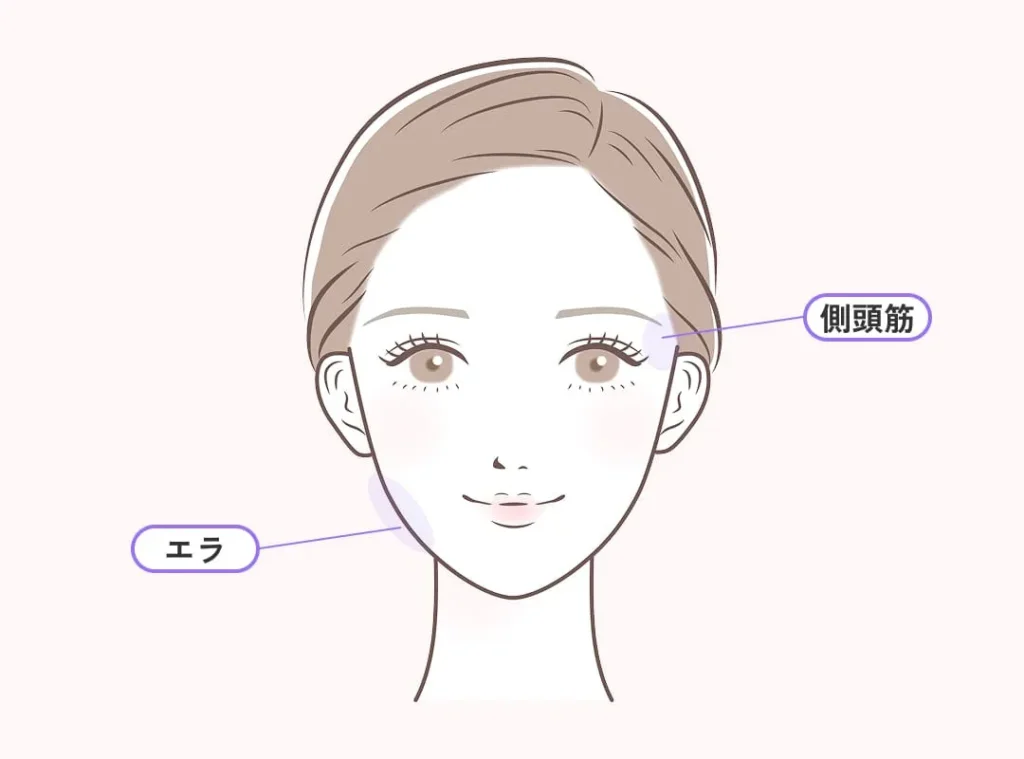 エラボトックス/側頭筋ボトックス