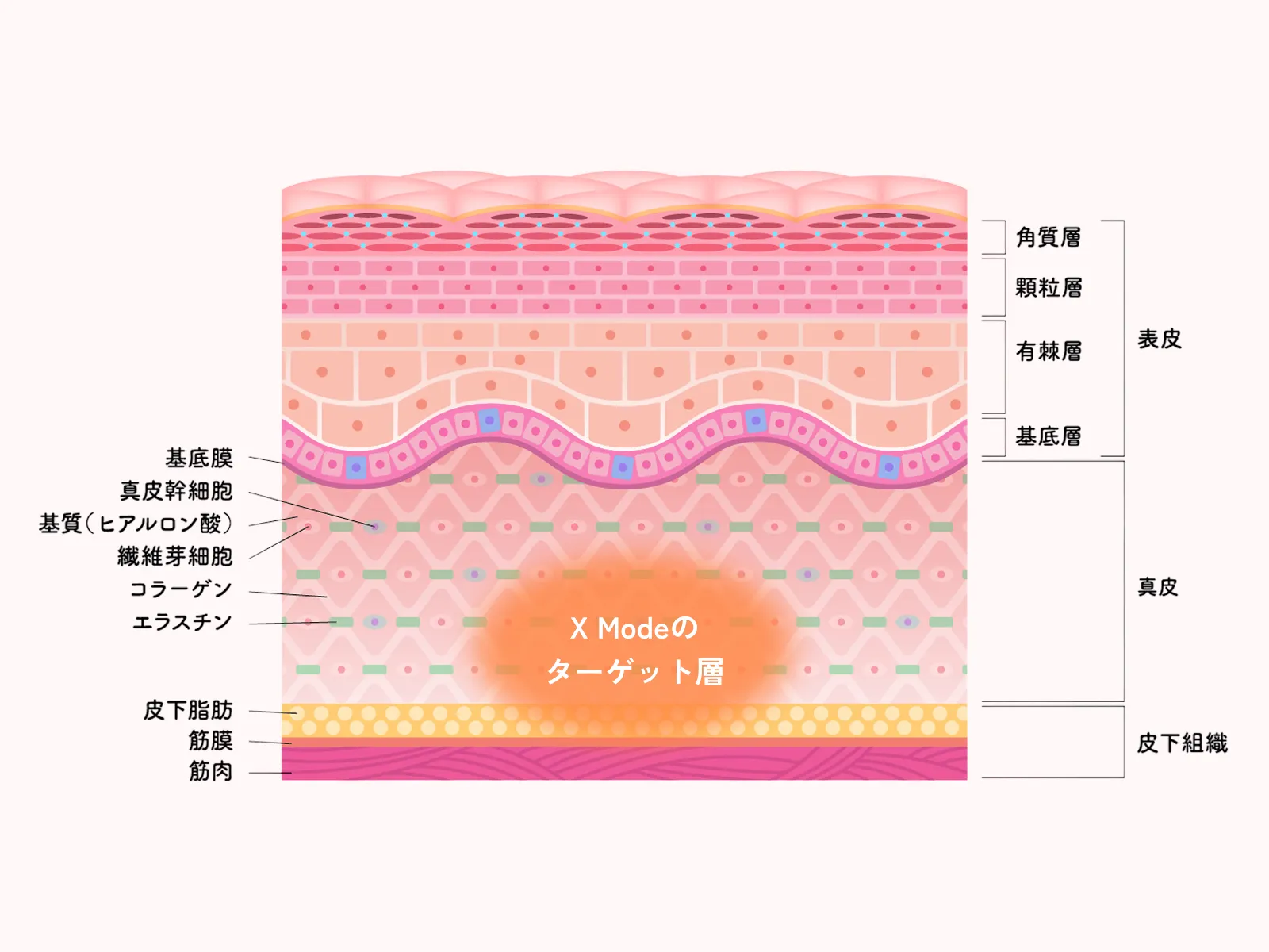 Xモードの概念図